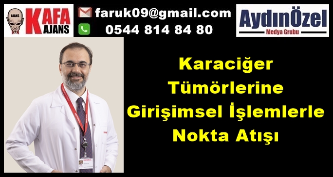 Karaciğer Tümörlerine Girişimsel İşlemlerle Nokta Atışı