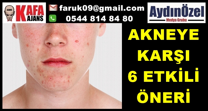 AKNEYE KARŞI 6 ETKİLİ ÖNERİ